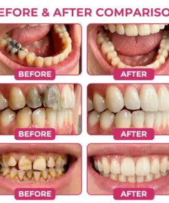 COUGEX® Cavity-Repair Natural Enamel Filling Gel