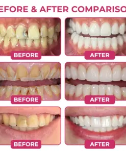 COUGEX® Cavity-Repair Natural Enamel Filling Gel